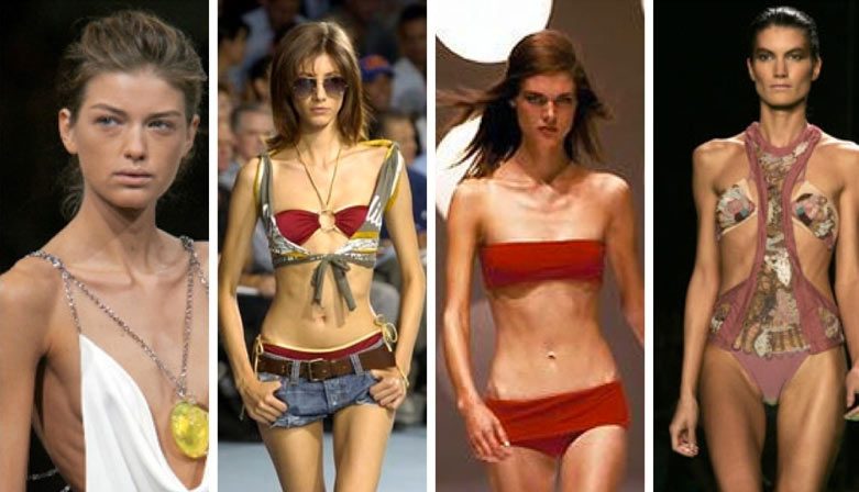 ATENCIÓN: La Ciencia Dice Que La Anorexia Es Contagiosa