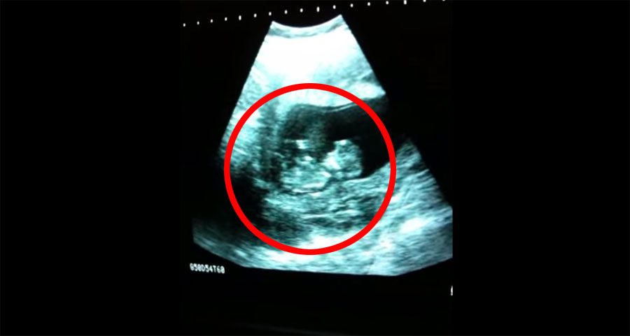 No ha nacido todavía... Y ha dejado a sus padres sin palabras 1 No Ha Nacido Todavía... Y Ha Dejado A Sus Padres Sin Palabras