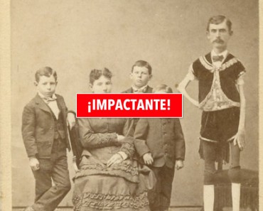 La Estremecedora Historia Del "Hombre Esqueleto" Que Te Asombrará 7 La Estremecedora Historia Del "Hombre Esqueleto" Que Te Asombrará 1