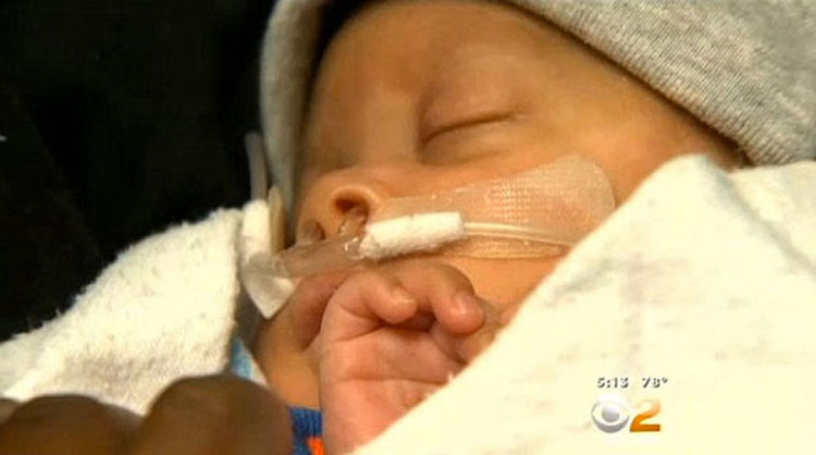 Milagro Médico: Bebé Prematuro Nace Dentro Del Saco Amniótico