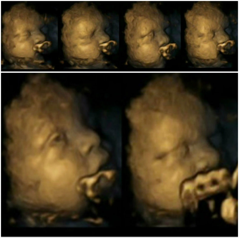 Impresionantes fotos de fetos muestran otra razón para NO FUMAR NUNCA durante el embarazo 3