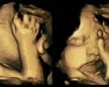Impresionantes fotos de fetos muestran otra razón para NO FUMAR NUNCA durante el embarazo 2