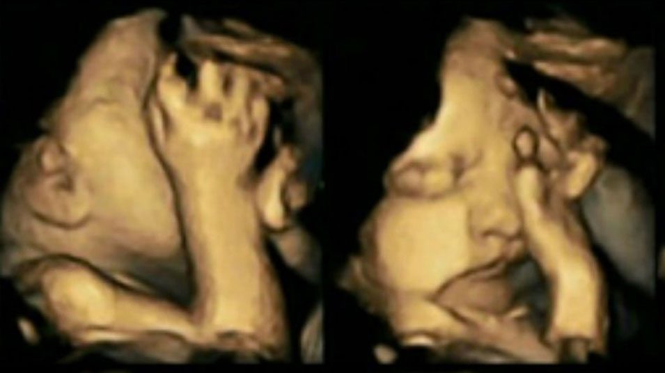Impresionantes fotos de fetos muestran otra razón para NO FUMAR NUNCA durante el embarazo 4