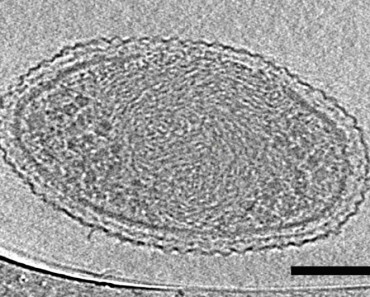 Científicos capturan las primeras imágenes microscópicas de la vida más pequeña posible 1