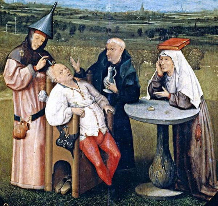 Los Procedimientos Médicos Más Dolorosos De La Época Medieval