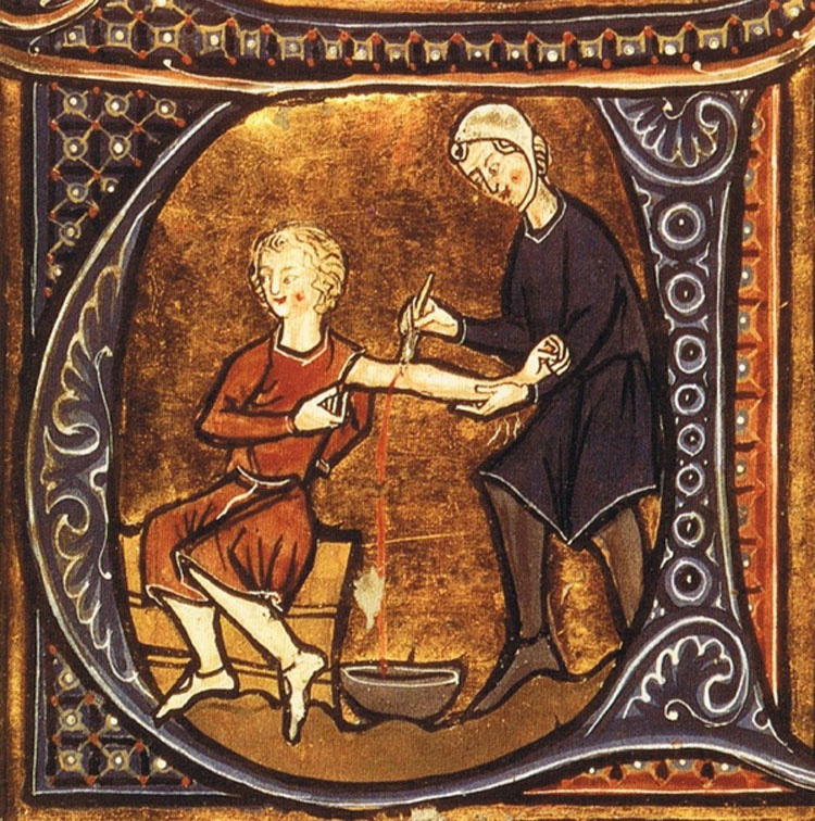 Los Procedimientos Médicos Más Dolorosos De La Época Medieval