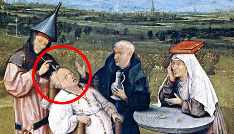 Los Procedimientos Médicos Más Dolorosos De La Época Medieval 1