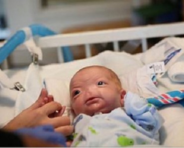 Conozca al adorable bebé que nació sin nariz y que es toda una SENSACIÓN en Internet 2