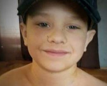 "Las cicatrices son hermosas": foto viral de un padre ayuda a curar la ANGUSTIA de las cicatrices de su hijo 1