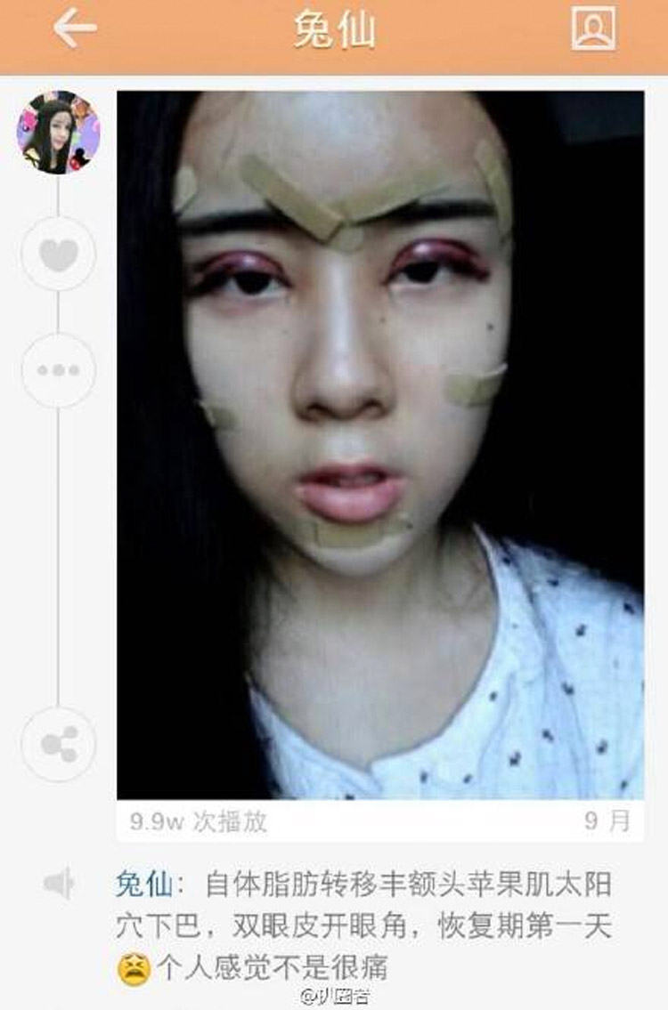 Esta niña china de 15 años se ha sometido a cirugía plástica extrema para parecerse a una muñeca