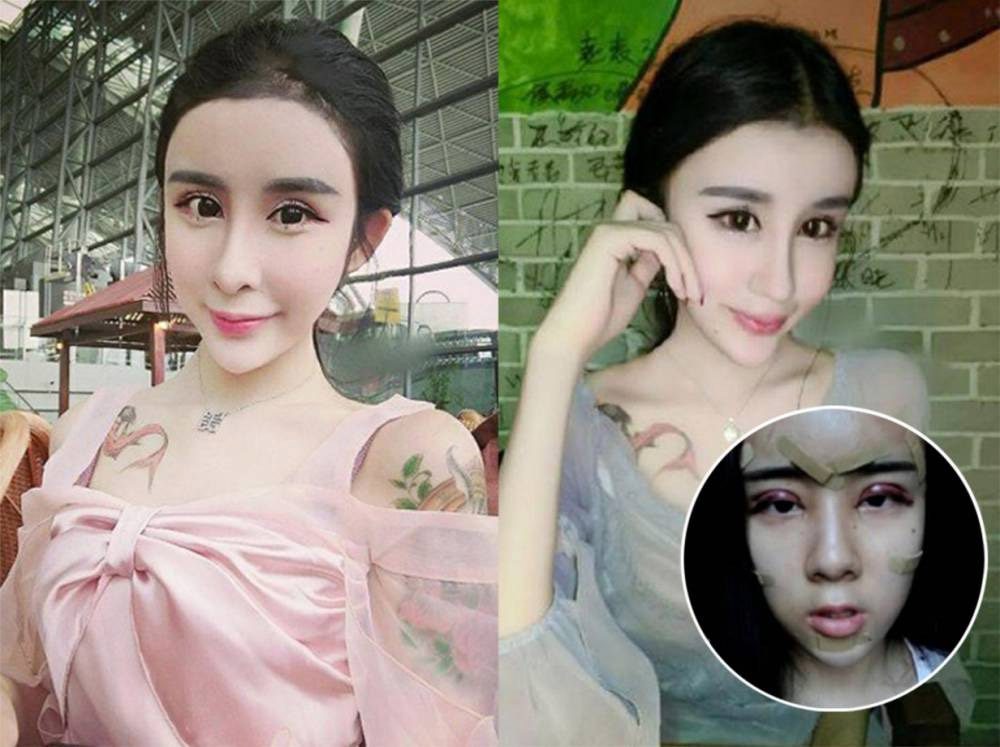 Esta niña china de 15 años se ha sometido a cirugía plástica extrema para parecerse a una muñeca