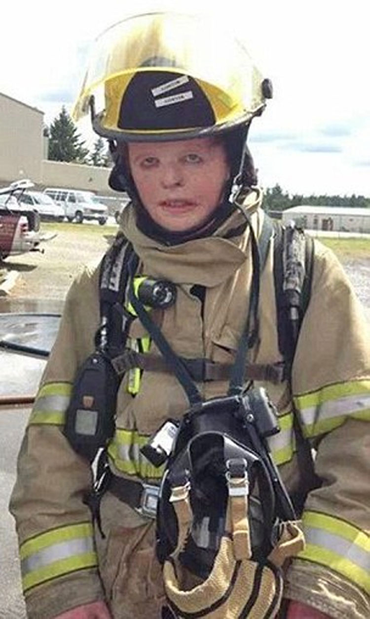 Un incendio devoró el 70% de su cuerpo cuando sólo tenía 6 años, pero mira lo que hace ahora...