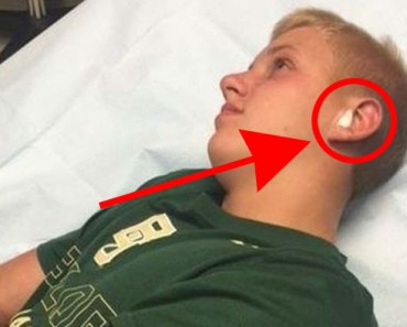 Sintió que algo se movía dentro de su oído... Lo que sacó te hará SENTIR NÁUSEAS 8 Sintió que algo se movía dentro de su oído... Lo que sacó te hará SENTIR NÁUSEAS