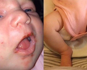 La foto de este mamá muestra por qué debe tener CUIDADO de quién besa a su bebé 3 La foto de este mamá muestra por qué debe ser cuidadoso de quién besa a su bebé