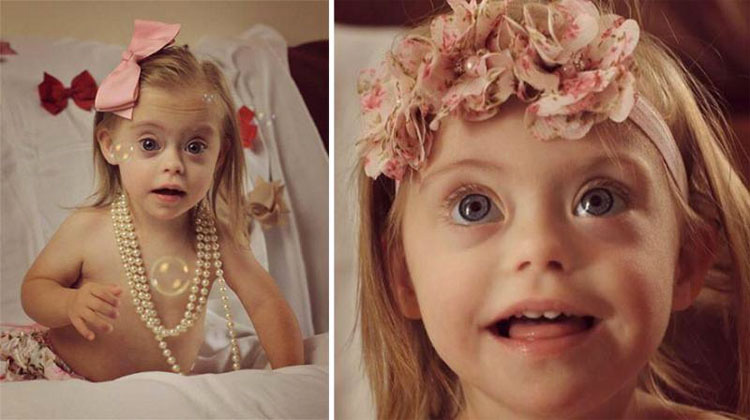 Niña con síndrome de Down gana dos contratos de modelo gracias a su sonrisa. ¡ES PRECIOSA! 10 Niña con síndrome de Down gana dos contratos de modelo gracias a su sonrisa. ¡ES PRECIOSA!