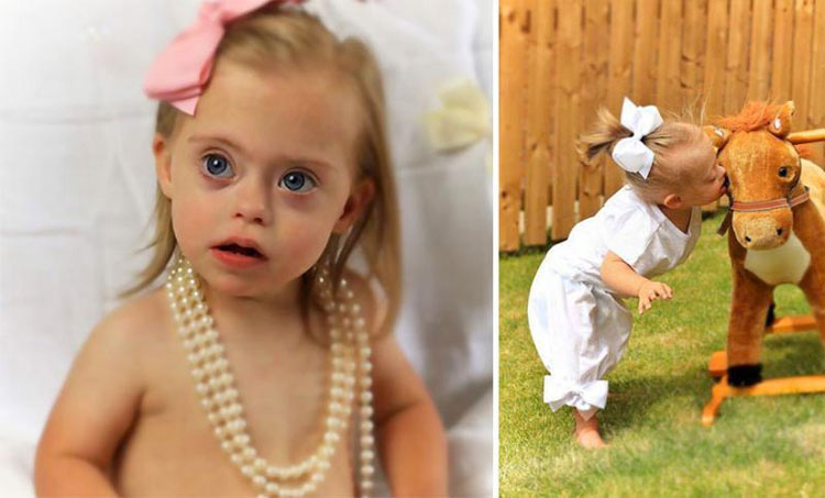 Niña con síndrome de Down gana dos contratos de modelo gracias a su sonrisa. ¡ES PRECIOSA! 11 Niña con síndrome de Down gana dos contratos de modelo gracias a su sonrisa. ¡ES PRECIOSA!