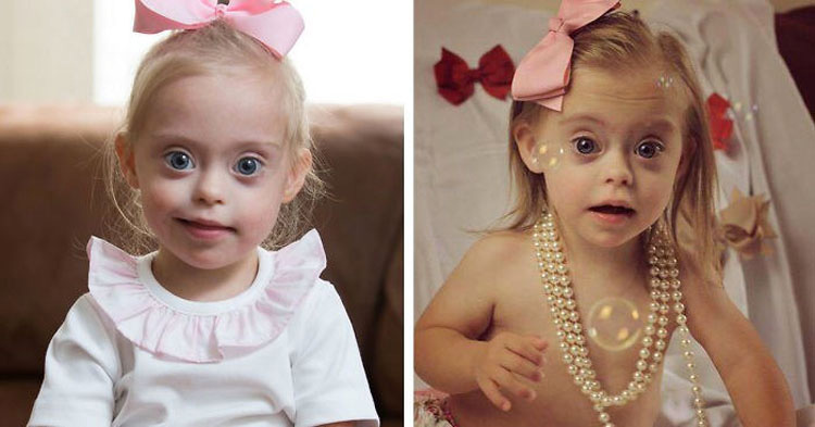 Niña con síndrome de Down gana dos contratos de modelo gracias a su sonrisa. ¡ES PRECIOSA! 12 Niña con síndrome de Down gana dos contratos de modelo gracias a su sonrisa. ¡ES PRECIOSA!
