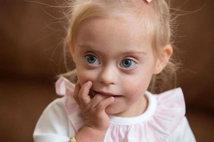 Niña con síndrome de Down gana dos contratos de modelo gracias a su sonrisa. ¡ES PRECIOSA!