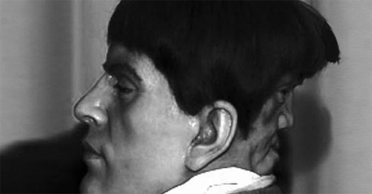 Edward Mordake, esta fue la terrible vida del hombre de la "cabeza diabólica"