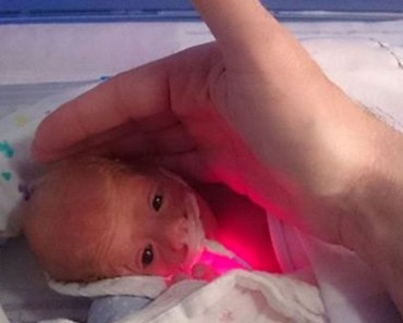Para mantener caliente a un bebé prematuro los médicos lo envolvieron en la cosa más pequeña que tenían a mano