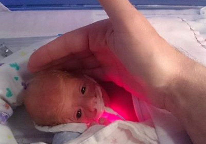 Para mantener caliente a un bebé prematuro los médicos lo envolvieron en la cosa más pequeña que tenían a mano