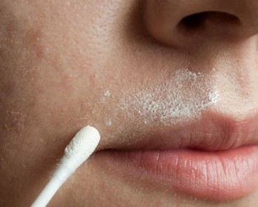 Con esta receta natural desterrarás el indeseado vello facial PARA SIEMPRE