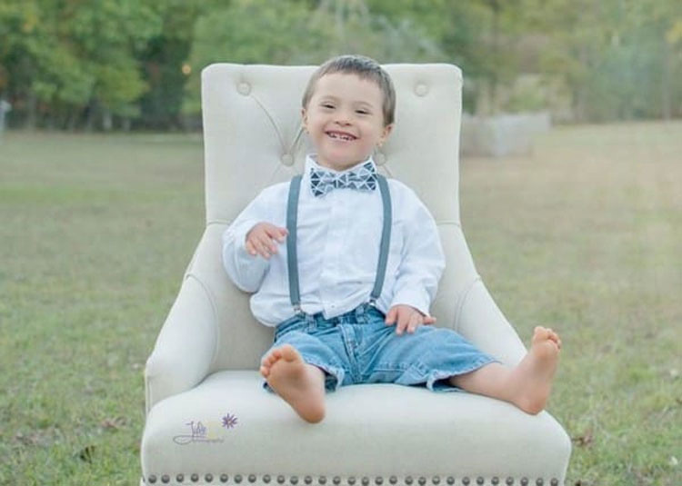 Esta mujer fotografía niños con Síndrome de Down para capturar su belleza. IMPRESIONANTE