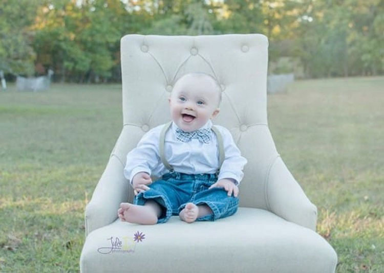 Esta mujer fotografía niños con Síndrome de Down para capturar su belleza. IMPRESIONANTE