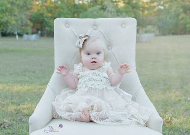 Esta mujer fotografía niños con Síndrome de Down para capturar su belleza. IMPRESIONANTE