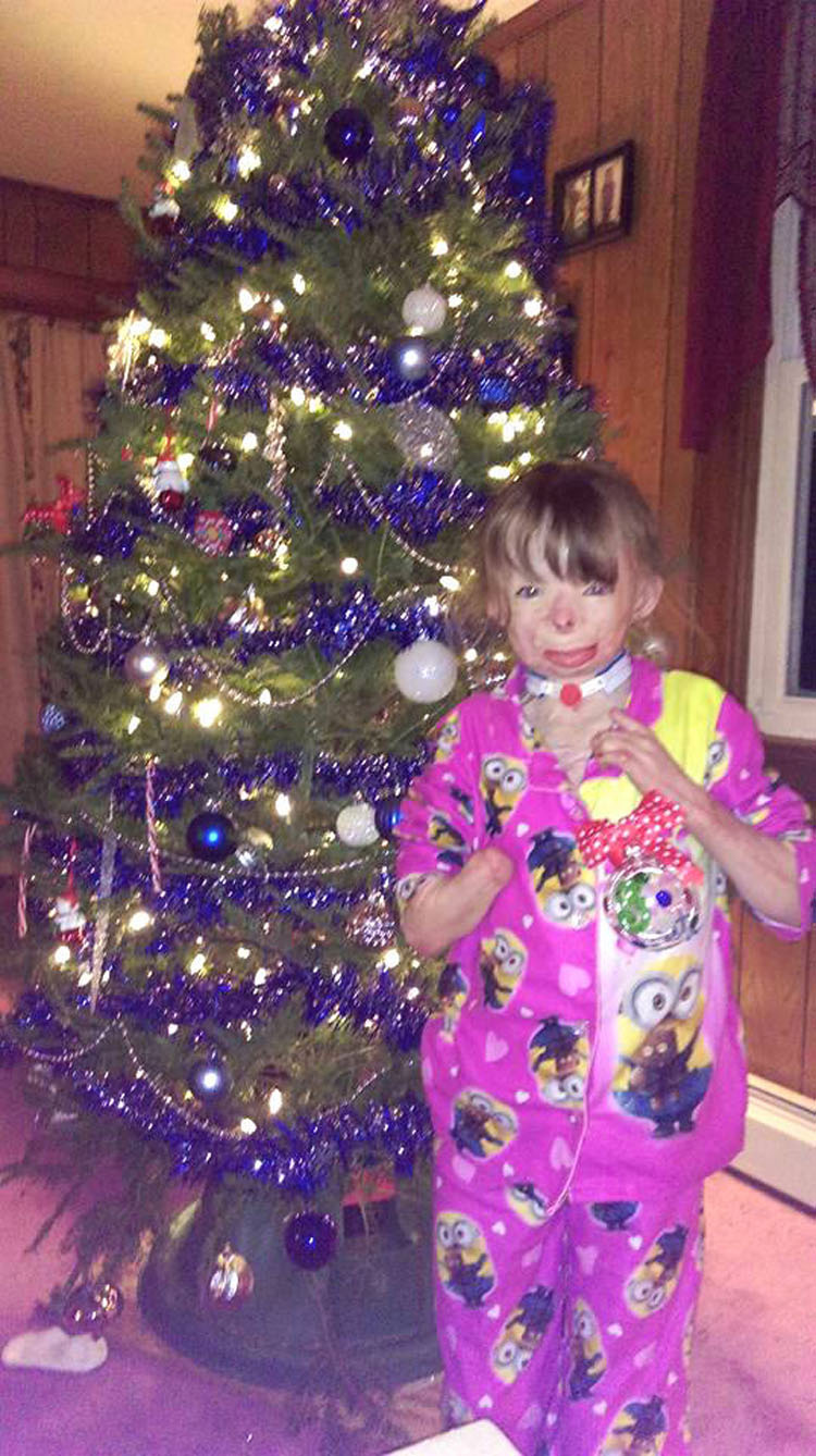 Un maníaco prendió fuego a la casa de esta niña de 5 años. Lo que pide esta Navidad es desgarrador...