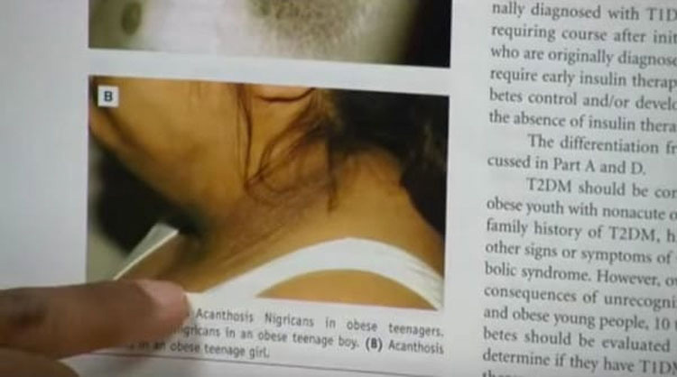 Esta mujer notó un anillo oscuro alrededor de su cuello, pero no esperaba que los médicos le dijeran esto...