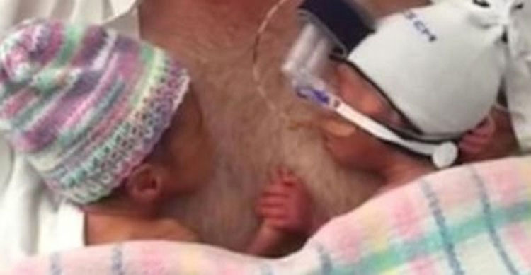 Tras el nacimiento de estos gemelos no esperaban esto, mira de cerca sus manos. ¡Increíble!