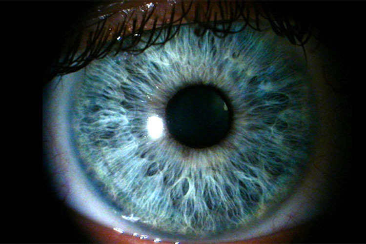 Científicos dicen que todas las personas con ojos azules tienen una cosa rara en común. No tenía ni idea 9 Científicos dicen que todas las personas con ojos azules tienen una cosa rara en común. No tenía ni idea