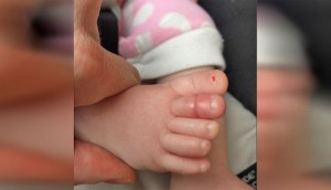 Un bebé tenía fiebre alta y lloraba. Su padre le quita el calcetín y ve esto en el dedo del pie...
