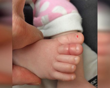 Un bebé tenía fiebre alta y lloraba. Su padre le quita el calcetín y ve esto en el dedo del pie... 5 Un bebé tenía fiebre alta y lloraba. Su padre le quita el calcetín y ve esto en el dedo del pie...