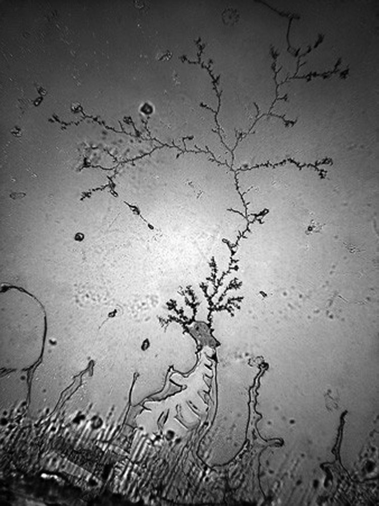 Ver nuestras lágrimas con un microscopio revela un hecho impactante