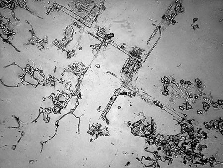 Ver nuestras lágrimas con un microscopio revela un hecho impactante