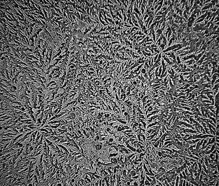 Ver nuestras lágrimas con un microscopio revela un hecho impactante