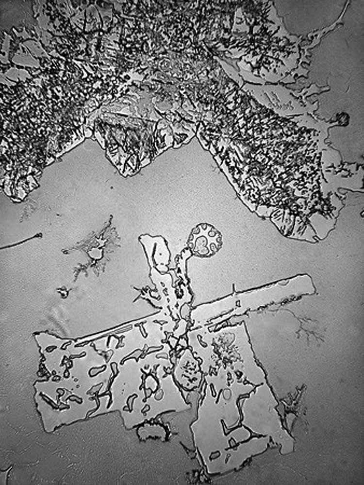 Ver nuestras lágrimas con un microscopio revela un hecho impactante