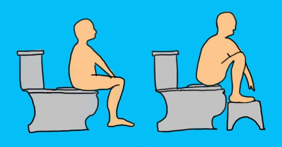 No tenía ni idea de que usar el baño de ESTA forma podría afectar a mi colon