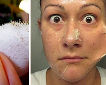 Frota 2 ingredientes en su cara y deja que se sequen. Lo que pasa más tarde querrás probarlo 3 Frota 2 ingredientes en su cara y deja que se sequen. Lo que pasa es minutos más tarde querrás probarlo