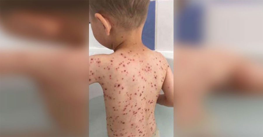 Su hijo llora con fiebre alta, entonces su madre se da cuenta del TERRIBLE error médico 6 Su hijo llora con fiebre alta, entonces su madre se da cuenta del TERRIBLE error médico
