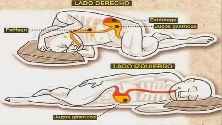 Esto es lo que sucede si duermes del lado izquierdo cada noche. Es sorprendente