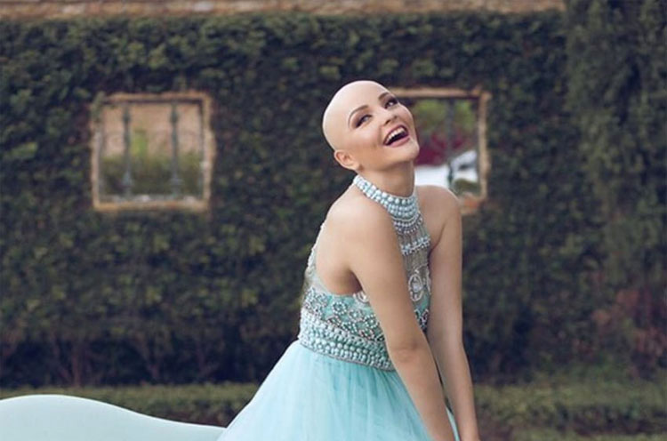 Esta preciosa chica de 17 años demuestra ASÍ que el cáncer no puede debilitar su hermoso espíritu