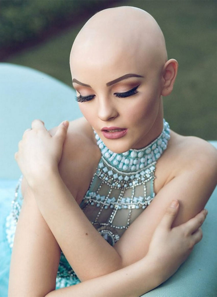 Esta preciosa chica de 17 años demuestra ASÍ que el cáncer no puede debilitar su hermoso espíritu