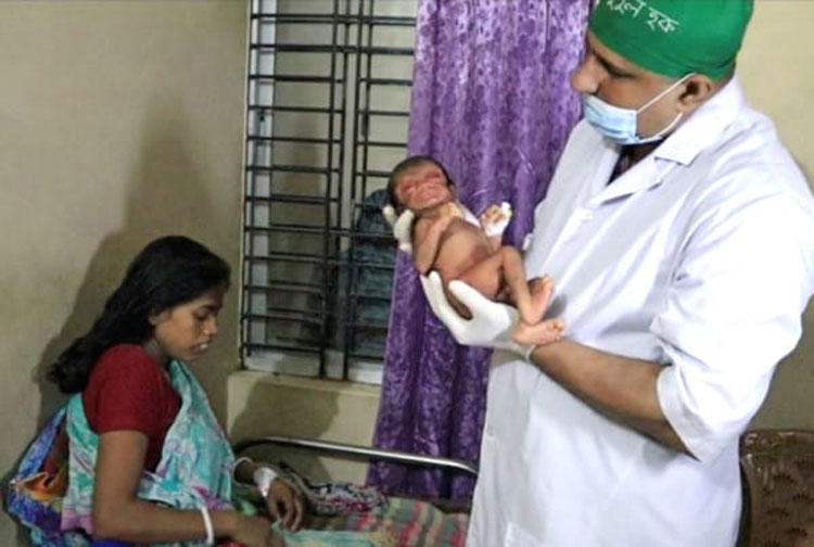 Cuando este niño nació los médicos dijeron a su madre que nunca habían visto algo así