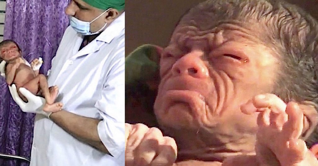 Cuando este niño nació los médicos dijeron a su madre que nunca habían visto algo así 7 Cuando este niño nació los médicos dijeron a su madre que nunca habían visto algo así