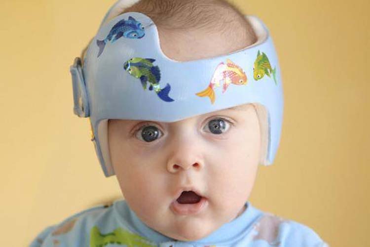 Dormir en una cuna puede prevenir y corregir el 'síndrome de la cabeza plana' en los bebés