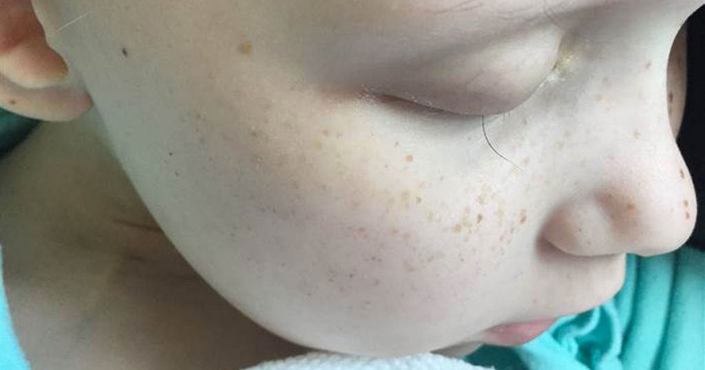 Un padre hace una foto de la última pestaña de su hija y la historia detrás de ella se hace viral