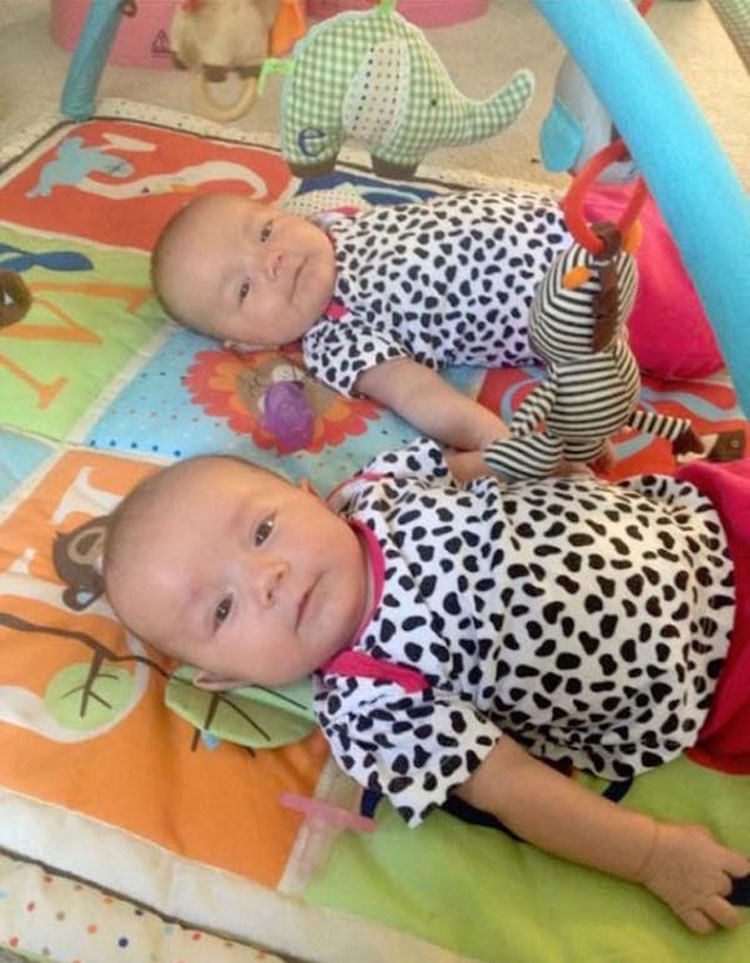 Estas gemelas se agarraron de la mano al nacer... ¡Y ahora son inseparables!